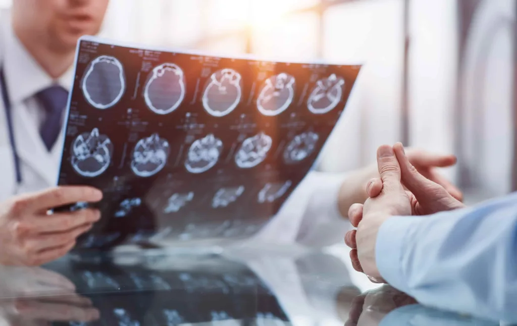 Doctor reviewing brain MRI scan with patient during medical consultation, discussing diagnosis and treatment options for neurological condition.