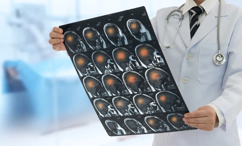 Medical professional reviewing brain imaging related to a traumatic brain injury