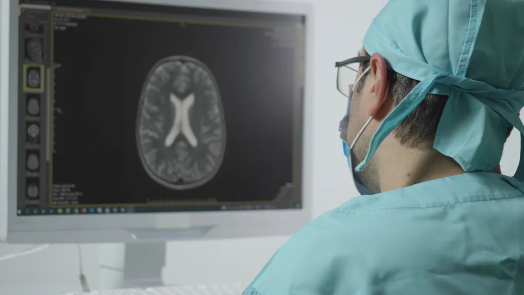 radiologist reviewing brain scan american